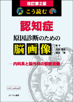 こう読む 認知症 原因診断のための脳画像 改訂第2版